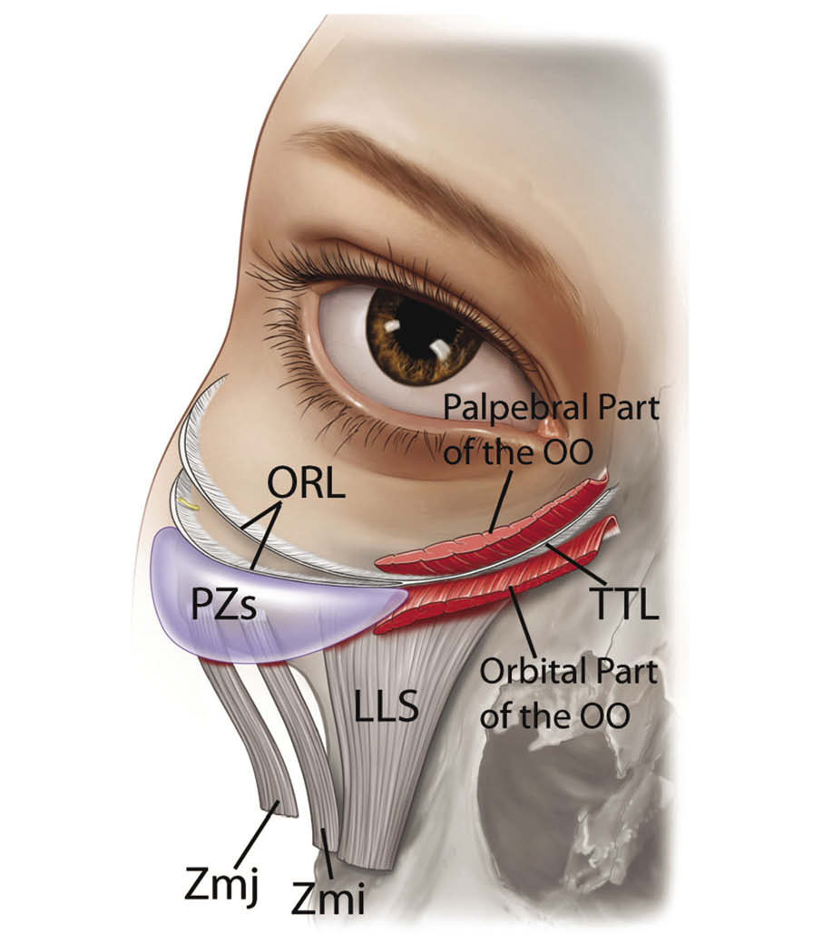 Tear trough ligament diagram